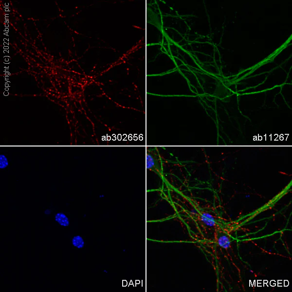 Immunocytochemistry/ Immunofluorescence - Alexa Fluor® 594 Anti-GAD65 antibody [EPR22952-70] (AB302656)