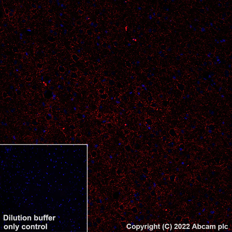 Immunohistochemistry (Formalin/PFA-fixed paraffin-embedded sections) - Alexa Fluor® 594 Anti-GAD67/GAD1 antibody [EPR20578] (AB306573)