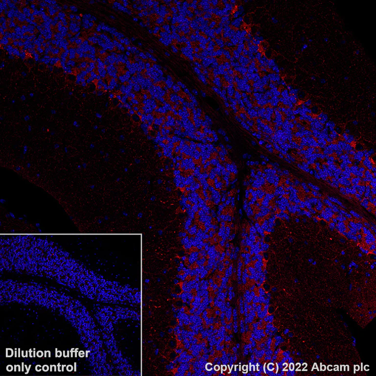 Immunohistochemistry (Formalin/PFA-fixed paraffin-embedded sections) - Alexa Fluor® 594 Anti-GAD67/GAD1 antibody [EPR20578] (AB306573)