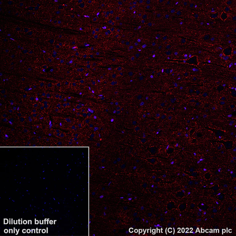 Immunohistochemistry (Formalin/PFA-fixed paraffin-embedded sections) - Alexa Fluor® 594 Anti-GAD67/GAD1 antibody [EPR20578] (AB306573)