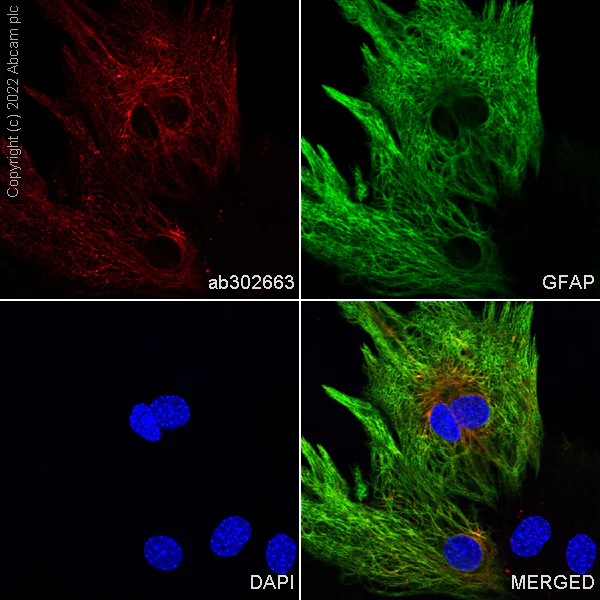 Immunocytochemistry/ Immunofluorescence - Alexa Fluor® 594 Anti-GFAP antibody [EP672Y] - Astrocyte Marker (AB302663)