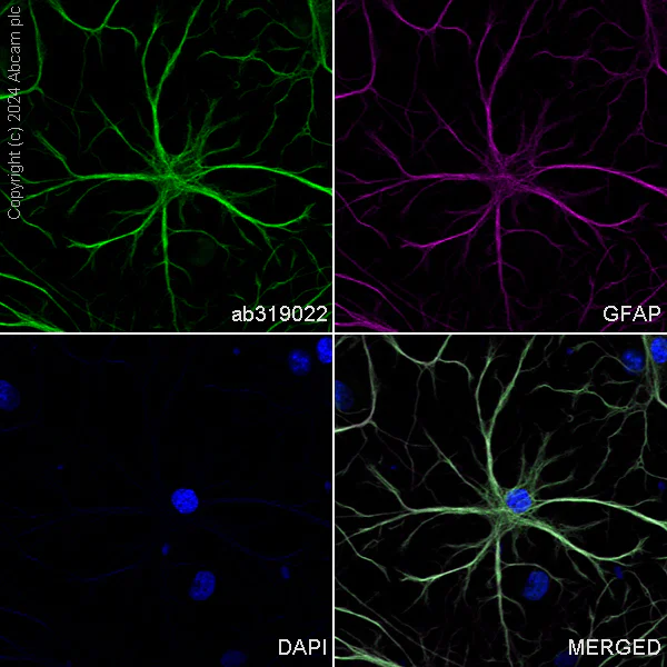 Immunocytochemistry/ Immunofluorescence - Alexa Fluor® 594 Anti-GFAP antibody [EPR1034Y] - Astrocyte Marker (AB201732)