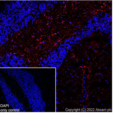 Immunohistochemistry (Frozen sections) - Alexa Fluor® 594 Anti-GFAP antibody [EPR1034Y] - Astrocyte Marker (AB201732)
