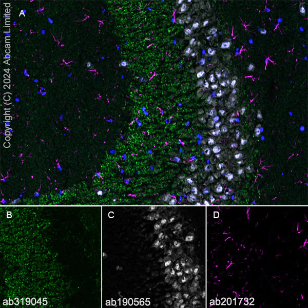 Immunohistochemistry (Frozen sections) - Alexa Fluor® 594 Anti-GFAP antibody [EPR1034Y] - Astrocyte Marker (AB201732)