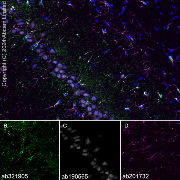 Immunohistochemistry (Frozen sections) - Alexa Fluor® 594 Anti-GFAP antibody [EPR1034Y] - Astrocyte Marker (AB201732)