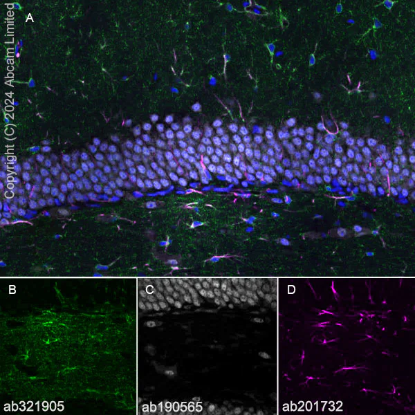 Immunohistochemistry (Frozen sections) - Alexa Fluor® 594 Anti-GFAP antibody [EPR1034Y] - Astrocyte Marker (AB201732)