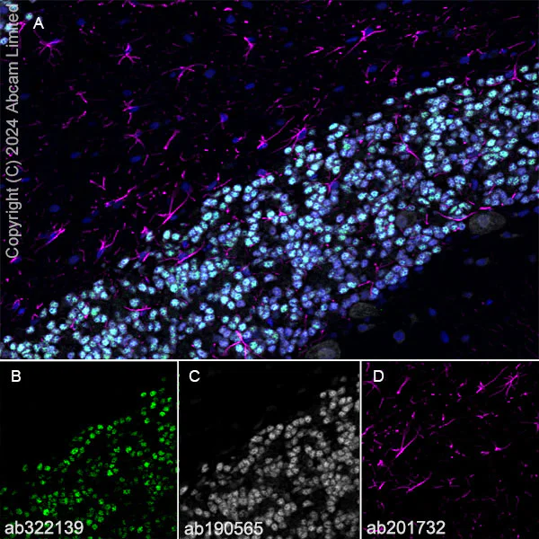 Immunohistochemistry (Frozen sections) - Alexa Fluor® 594 Anti-GFAP antibody [EPR1034Y] - Astrocyte Marker (AB201732)