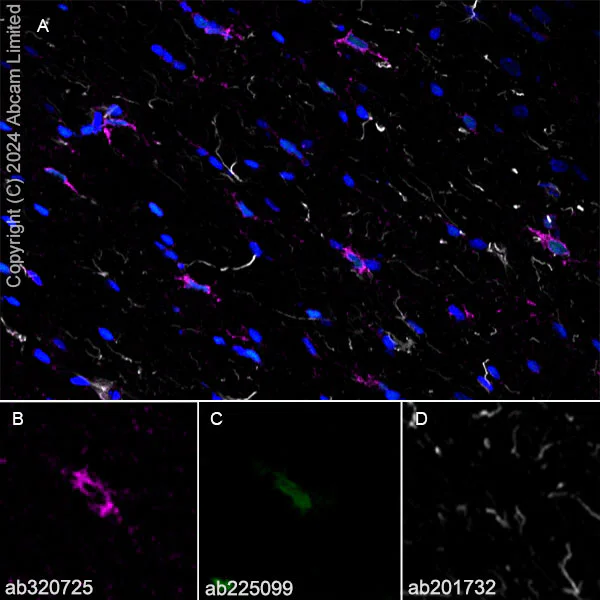 Immunohistochemistry (Frozen sections) - Alexa Fluor® 594 Anti-GFAP antibody [EPR1034Y] - Astrocyte Marker (AB201732)
