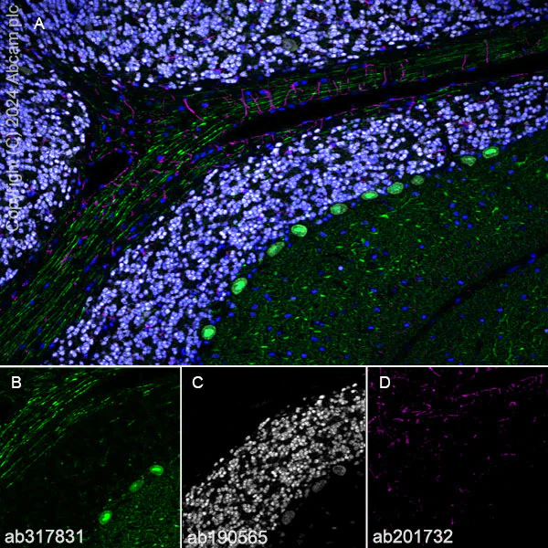 Immunohistochemistry (Frozen sections) - Alexa Fluor® 594 Anti-GFAP antibody [EPR1034Y] - Astrocyte Marker (AB201732)
