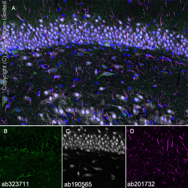 Immunohistochemistry (Frozen sections) - Alexa Fluor® 594 Anti-GFAP antibody [EPR1034Y] - Astrocyte Marker (AB201732)
