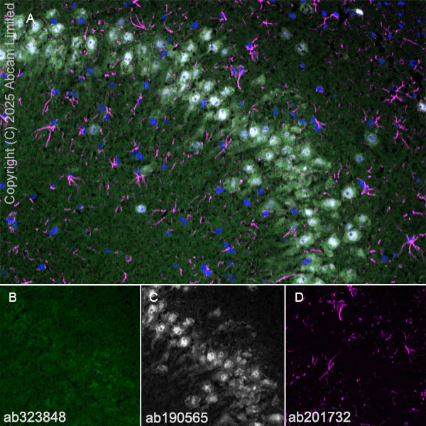 Immunohistochemistry (Frozen sections) - Alexa Fluor® 594 Anti-GFAP antibody [EPR1034Y] - Astrocyte Marker (AB201732)