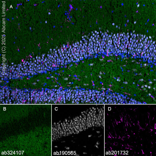 Immunohistochemistry (Frozen sections) - Alexa Fluor® 594 Anti-GFAP antibody [EPR1034Y] - Astrocyte Marker (AB201732)