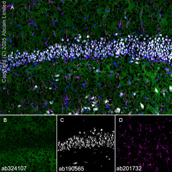 Immunohistochemistry (Frozen sections) - Alexa Fluor® 594 Anti-GFAP antibody [EPR1034Y] - Astrocyte Marker (AB201732)