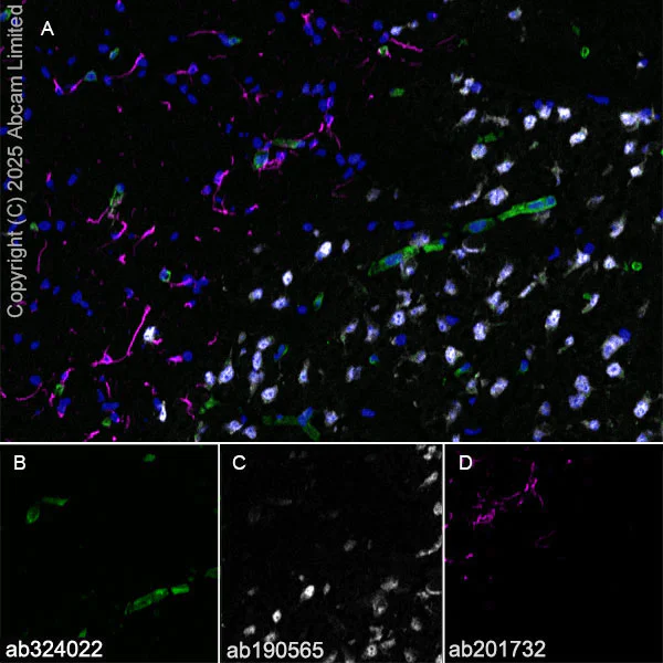 Immunohistochemistry (Frozen sections) - Alexa Fluor® 594 Anti-GFAP antibody [EPR1034Y] - Astrocyte Marker (AB201732)