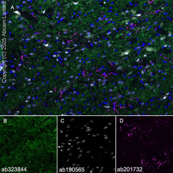 Immunohistochemistry (Frozen sections) - Alexa Fluor® 594 Anti-GFAP antibody [EPR1034Y] - Astrocyte Marker (AB201732)