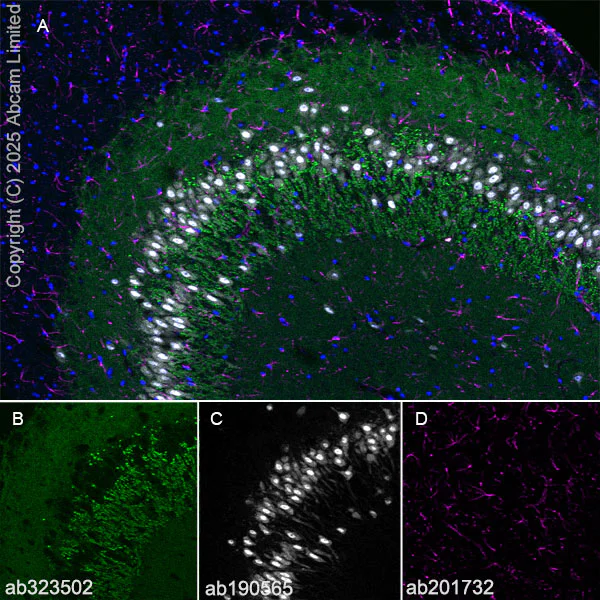 Immunohistochemistry (Frozen sections) - Alexa Fluor® 594 Anti-GFAP antibody [EPR1034Y] - Astrocyte Marker (AB201732)