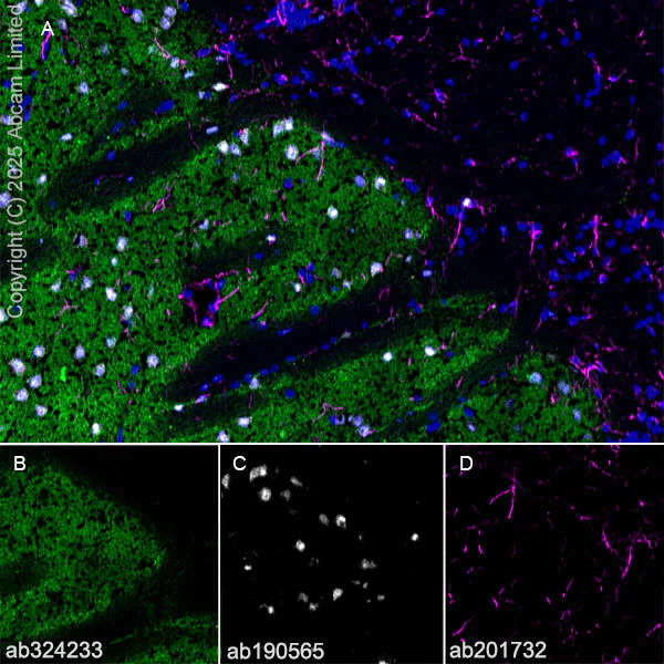 Immunohistochemistry (Frozen sections) - Alexa Fluor® 594 Anti-GFAP antibody [EPR1034Y] - Astrocyte Marker (AB201732)