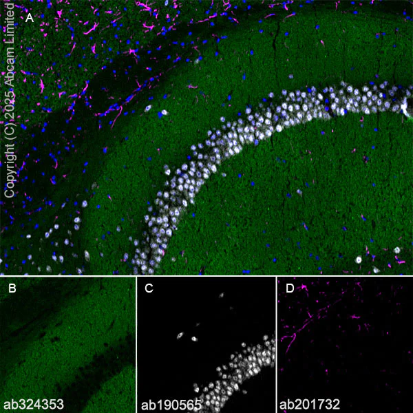 Immunohistochemistry (Frozen sections) - Alexa Fluor® 594 Anti-GFAP antibody [EPR1034Y] - Astrocyte Marker (AB201732)