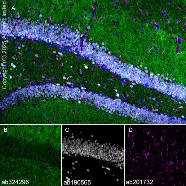 Immunohistochemistry (Frozen sections) - Alexa Fluor® 594 Anti-GFAP antibody [EPR1034Y] - Astrocyte Marker (AB201732)