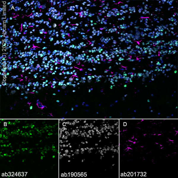 Immunohistochemistry (Frozen sections) - Alexa Fluor® 594 Anti-GFAP antibody [EPR1034Y] - Astrocyte Marker (AB201732)