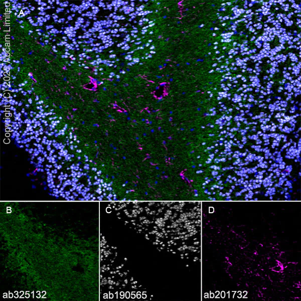 Immunohistochemistry (Frozen sections) - Alexa Fluor® 594 Anti-GFAP antibody [EPR1034Y] - Astrocyte Marker (AB201732)