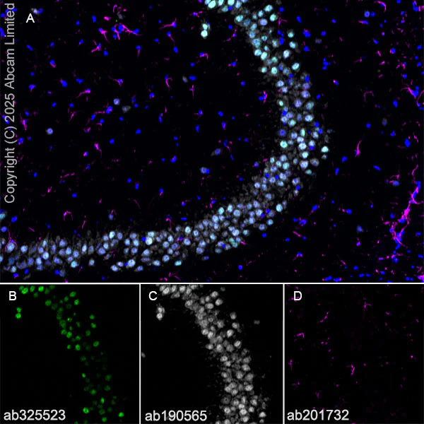 Immunohistochemistry (Frozen sections) - Alexa Fluor® 594 Anti-GFAP antibody [EPR1034Y] - Astrocyte Marker (AB201732)