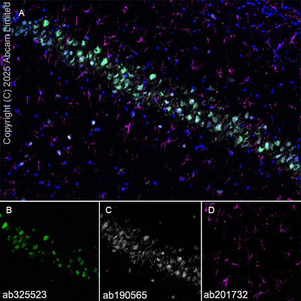 Immunohistochemistry (Frozen sections) - Alexa Fluor® 594 Anti-GFAP antibody [EPR1034Y] - Astrocyte Marker (AB201732)