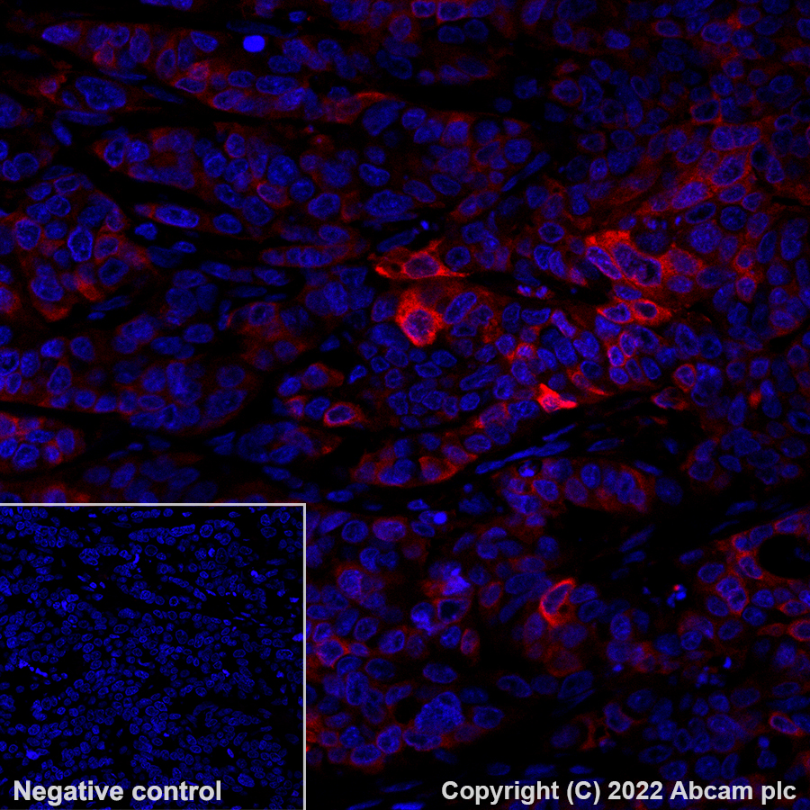 Immunohistochemistry (Formalin/PFA-fixed paraffin-embedded sections) - Alexa Fluor® 594 Anti-Glutamine Synthetase antibody [EPR13022(B)] (AB305118), expandable thumbnail