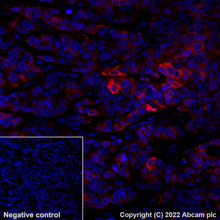 Immunohistochemistry (Formalin/PFA-fixed paraffin-embedded sections) - Alexa Fluor® 594 Anti-Glutamine Synthetase antibody [EPR13022(B)] (AB305118)