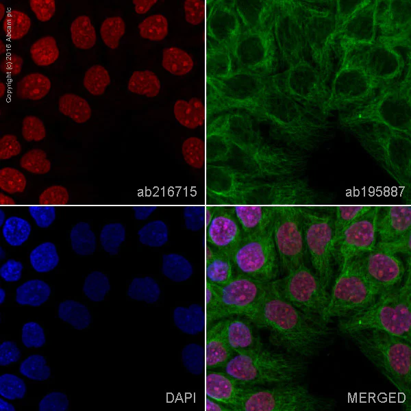 アルカラ CD10枚 Amazon.co.jp: CD アルカラ サビヅメ: ミュージック