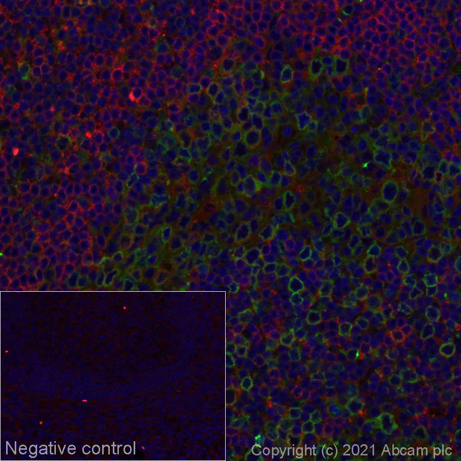 Immunohistochemistry (Formalin/PFA-fixed paraffin-embedded sections) - Alexa Fluor® 594 Anti-HLA-DPB1 antibody [EPR11226] (AB277933)