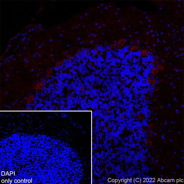 Immunohistochemistry (Frozen sections) - Alexa Fluor® 594 Anti-Huntingtin antibody [EPR5526] (AB302693)