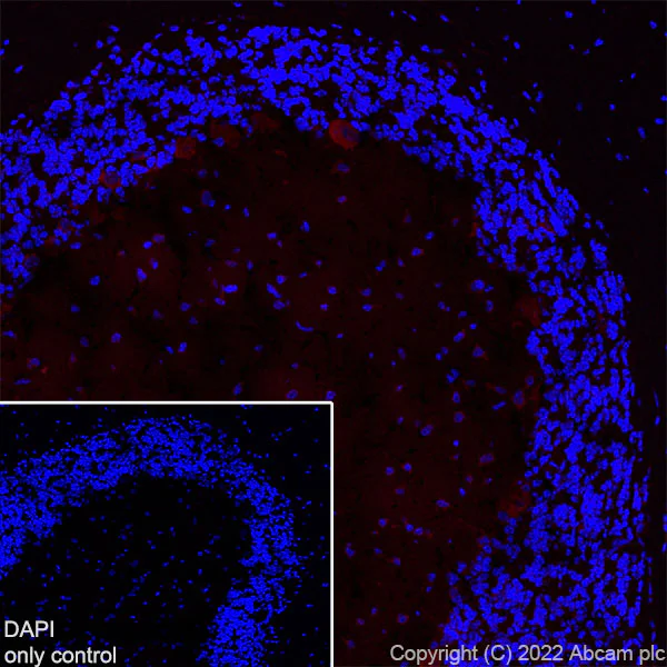 Immunohistochemistry (Frozen sections) - Alexa Fluor® 594 Anti-Huntingtin antibody [EPR5526] (AB302693)