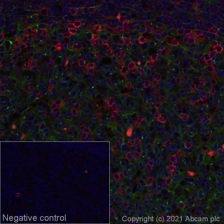 Immunohistochemistry (Formalin/PFA-fixed paraffin-embedded sections) - Alexa Fluor® 594 Anti-ICOS antibody [EPR20560] (AB281771)