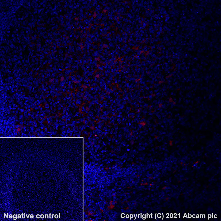 Immunohistochemistry (Formalin/PFA-fixed paraffin-embedded sections) - Alexa Fluor® 594 Anti-Indoleamine 2, 3-dioxygenase antibody [EPR20374] (AB282278)