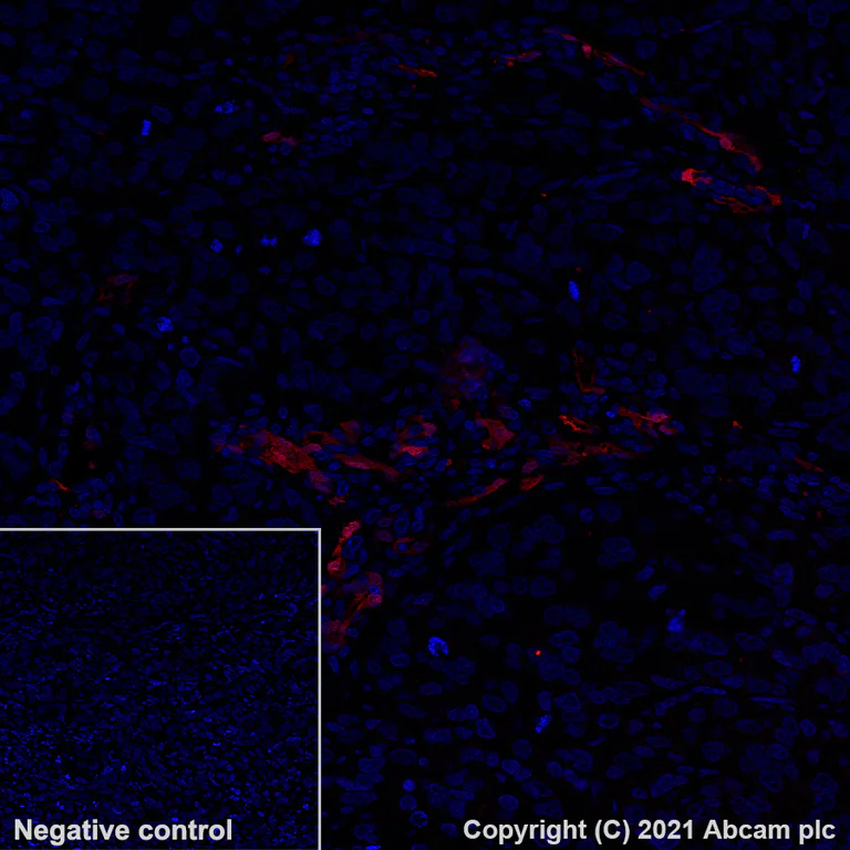 Immunohistochemistry (Formalin/PFA-fixed paraffin-embedded sections) - Alexa Fluor® 594 Anti-Indoleamine 2, 3-dioxygenase antibody [EPR20374] (AB282278)
