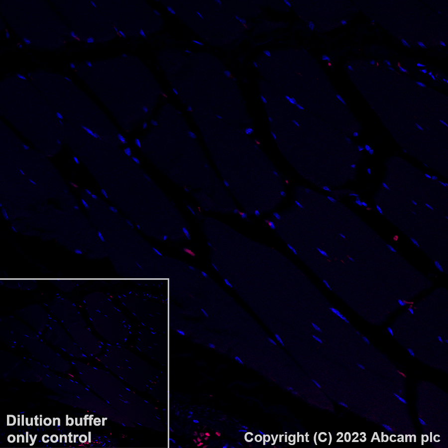 Immunohistochemistry (Formalin/PFA-fixed paraffin-embedded sections) - Alexa Fluor® 594 Anti-Interferon gamma antibody [EPR21704] (AB308599), expandable thumbnail