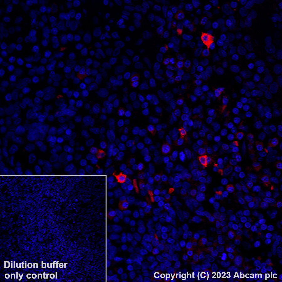 Immunohistochemistry (Formalin/PFA-fixed paraffin-embedded sections) - Alexa Fluor® 594 Anti-Interferon gamma antibody [EPR21704] (AB308599), expandable thumbnail
