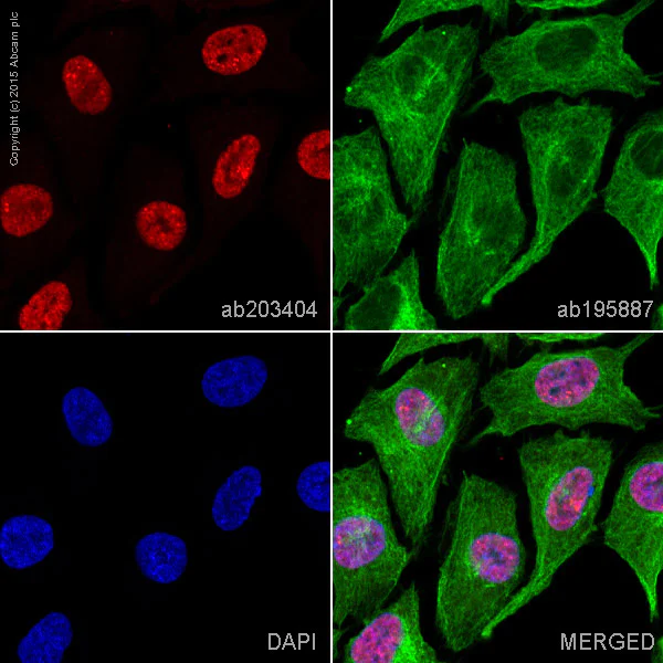 Immunocytochemistry/ Immunofluorescence - Alexa Fluor® 594 Anti-Islet 1 antibody [EP4182] - Neural Stem Cell Marker (AB203404)