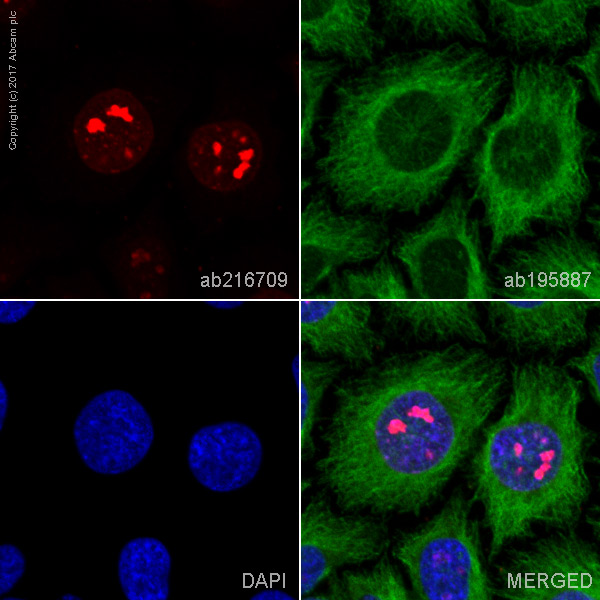 Immunocytochemistry - Alexa Fluor® 594 Anti-Ki67 antibody [EPR3610] (AB216709), expandable thumbnail