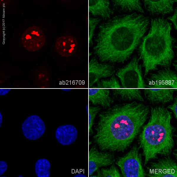 Immunocytochemistry - Alexa Fluor® 594 Anti-Ki67 antibody [EPR3610] (AB216709)