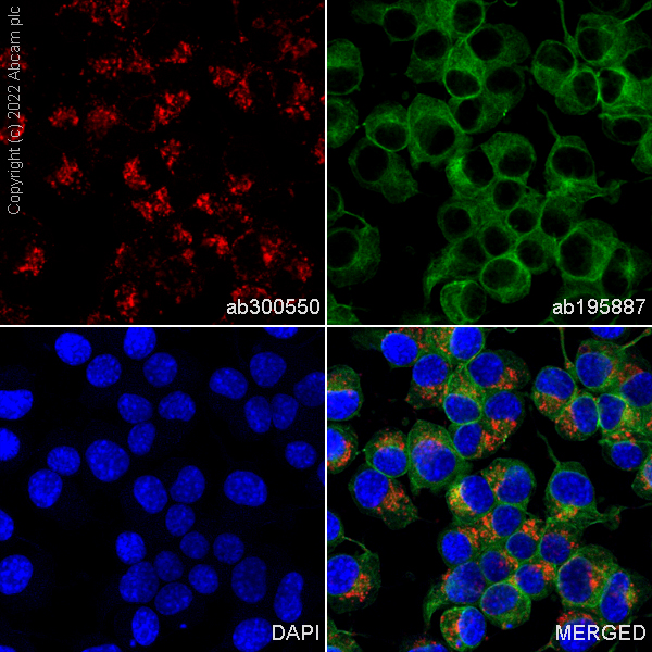 Immunocytochemistry/ Immunofluorescence - Alexa Fluor® 594 Anti-LAMP1 antibody [EPR21026] - Lysosome Marker (AB302684), expandable thumbnail