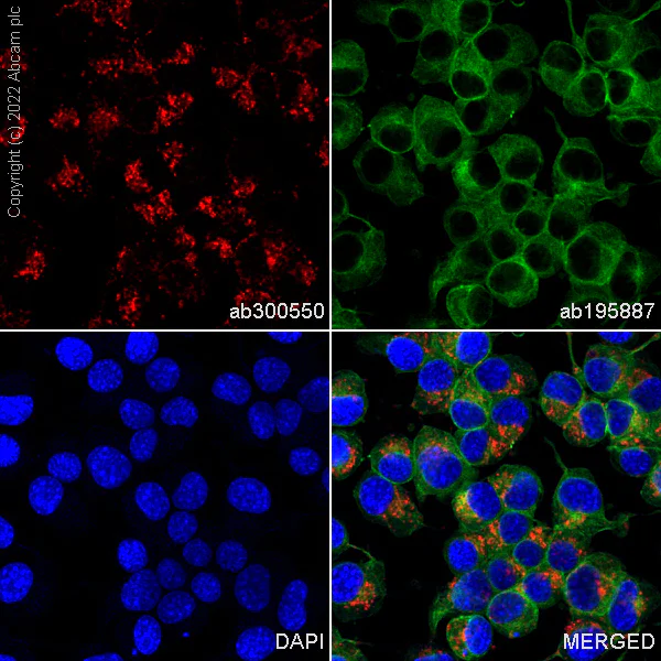 Immunocytochemistry/ Immunofluorescence - Alexa Fluor® 594 Anti-LAMP1 antibody [EPR21026] - Lysosome Marker (AB302684)