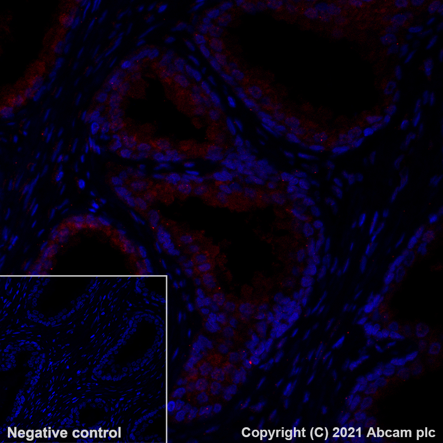 Immunohistochemistry (Formalin/PFA-fixed paraffin-embedded sections) - Alexa Fluor® 594 Anti-LAMP2A antibody [EPR4207(2)] (AB281931), expandable thumbnail