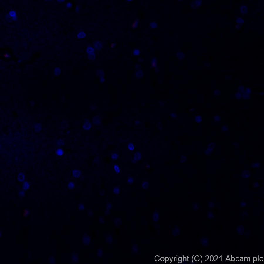Immunohistochemistry (Formalin/PFA-fixed paraffin-embedded sections) - Alexa Fluor® 594 Anti-LAMP2A antibody [EPR4207(2)] (AB281931), expandable thumbnail