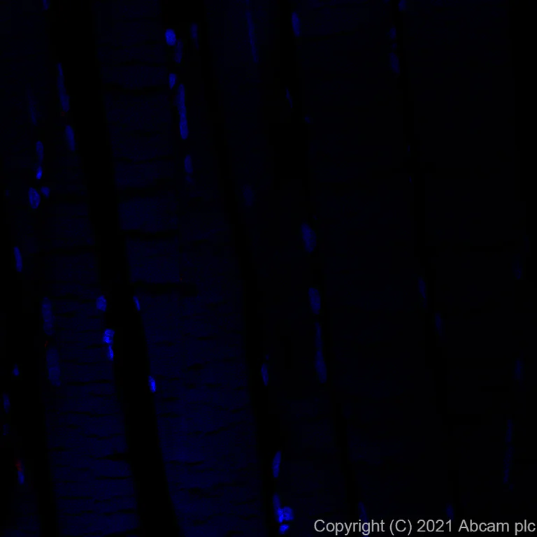 Immunohistochemistry (Formalin/PFA-fixed paraffin-embedded sections) - Alexa Fluor® 594 Anti-LAMP2A antibody [EPR4207(2)] - Lysosome Marker (AB281931)