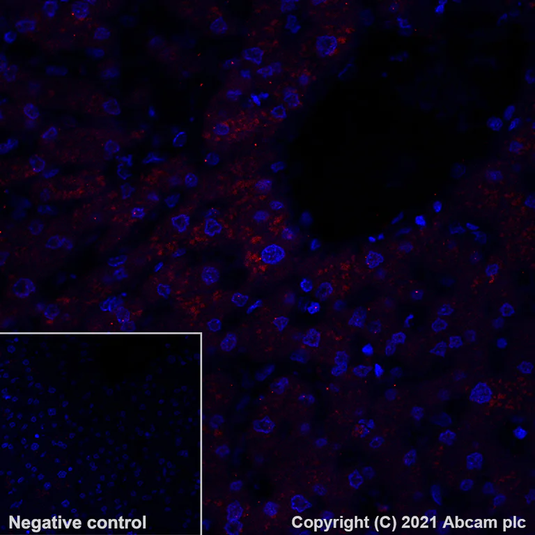 Immunohistochemistry (Formalin/PFA-fixed paraffin-embedded sections) - Alexa Fluor® 594 Anti-LAMP2A antibody [EPR4207(2)] - Lysosome Marker (AB281931)