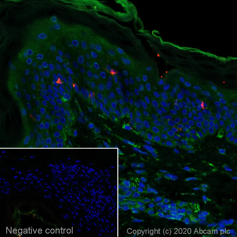 Immunohistochemistry (Formalin/PFA-fixed paraffin-embedded sections) - Alexa Fluor® 594 Anti-Langerin antibody [EPR15863] (AB275353)