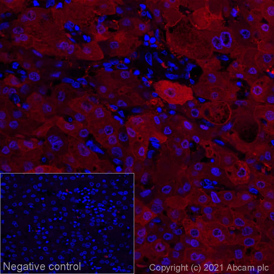 Immunohistochemistry (Formalin/PFA-fixed paraffin-embedded sections) - Alexa Fluor® 594 Anti-Liver Arginase antibody [EPR6672(B)] (AB277930), expandable thumbnail
