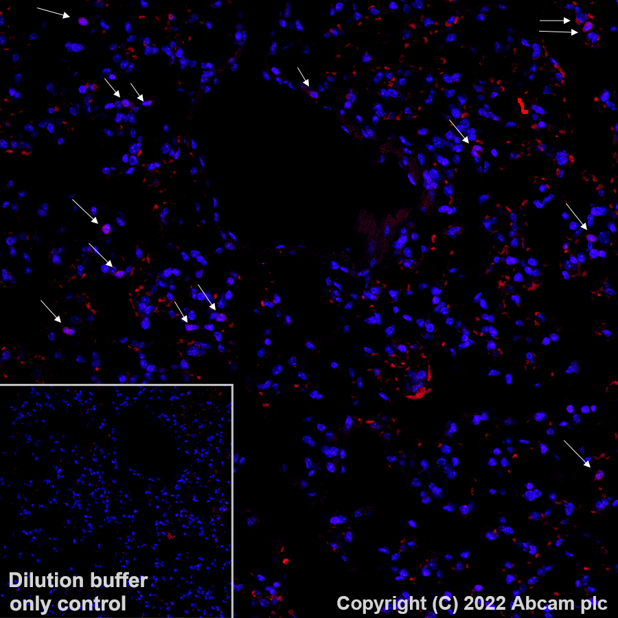 Immunohistochemistry (Formalin/PFA-fixed paraffin-embedded sections) - Alexa Fluor® 594 Anti-Ly6g antibody [EPR22909-135] (AB307167), expandable thumbnail